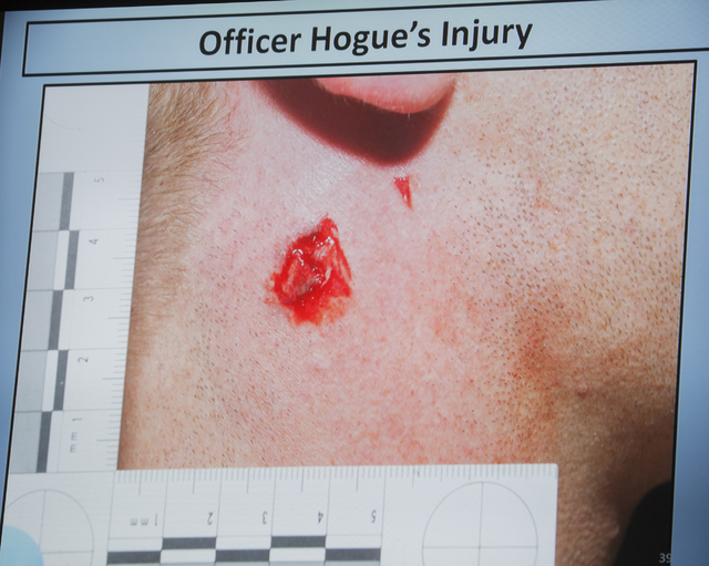 A video screen image shows a bullet wound on the neck of officer Evan Hogue, 28, during a fact-finding review at the Clark County Government Center, Friday, May 20, 2016. (Jeff Scheid/Las Vegas Re ...