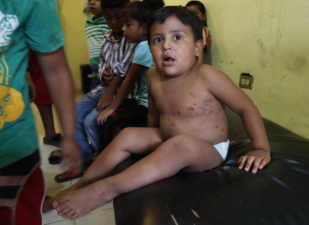 A migrant child waits to be treated for an unknown infection on his body at the Jesus del Buen ...