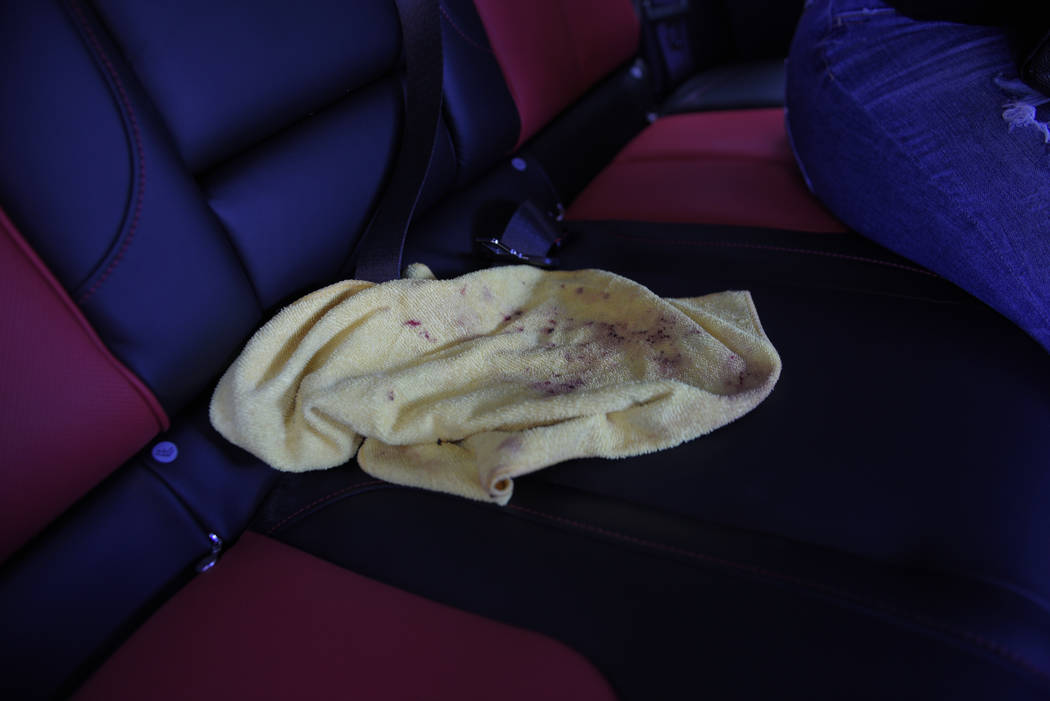 A bloodied towel sits in the vehicle that was used to rush Boston Red Sox slugger David Ortiz t ...