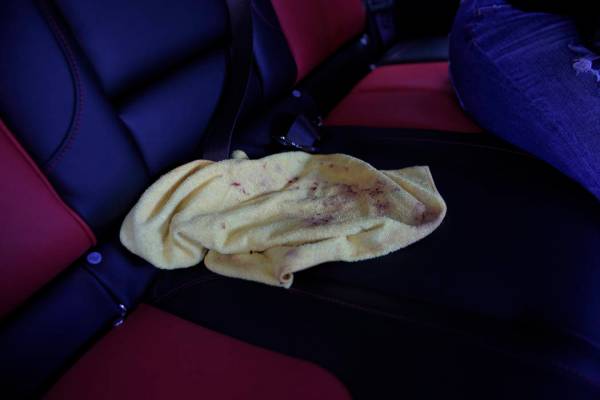 A bloodied towel sits in the vehicle that was used to rush Boston Red Sox slugger David Ortiz t ...