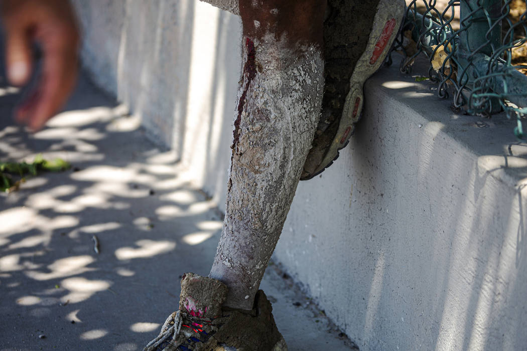 David Carnell's legs are covered in cement after helping children injured in a fatal crash on W ...