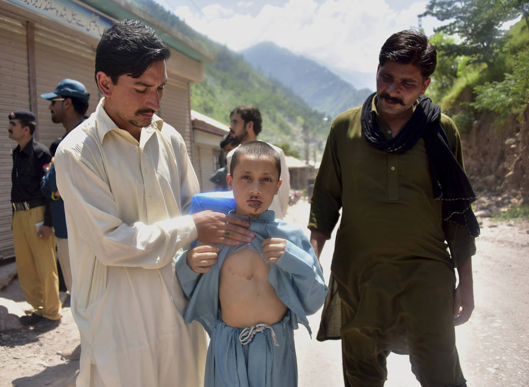 A Pakistani Kashmiri father, left, shows the wounds his son Mazhar Hussain received when Indian ...