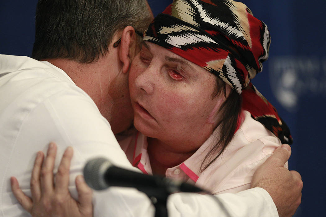 Carmen Blandin Tarleton of Thetford, Vt., embraces her surgeon, Dr. Bohdan Pomahac, during a ne ...