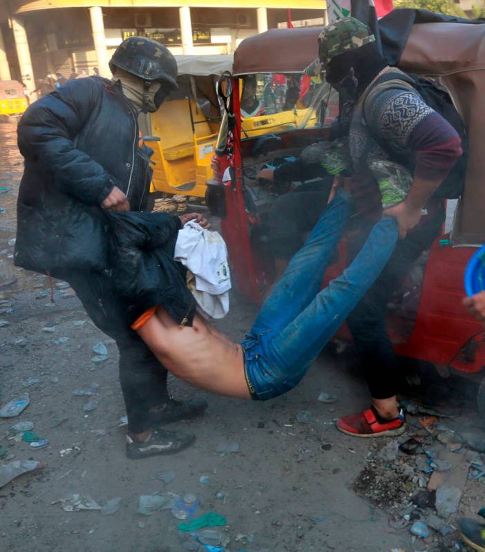 An injured protester is rushed to a hospital during clashes between security forces and anti-go ...