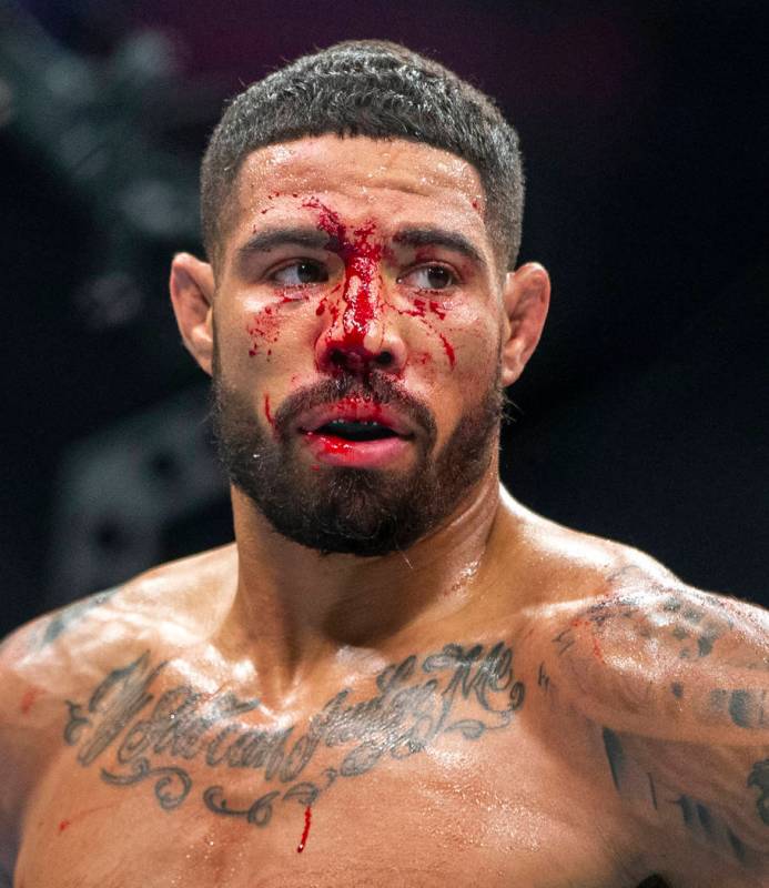 Welterweight Max Griffin is bloodied as he battles Alex Oliveira during the second round their ...