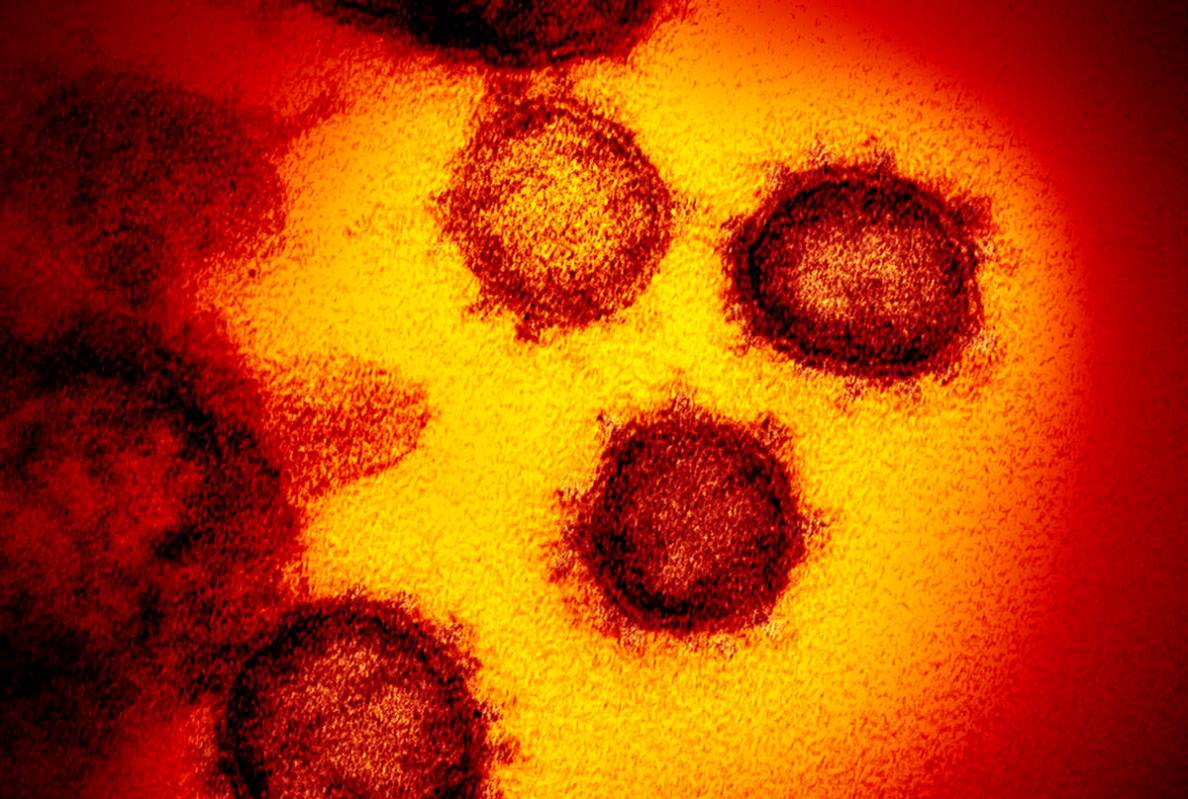 Novel Coronavirus - COVID-19 (AP)