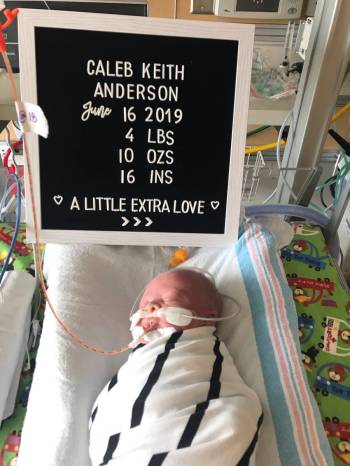 Caleb Anderson was born prematurely at 34 weeks. Doctors said he stopped growing inside the wom ...