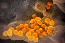 The novel coronavirus, seen in an image from an electron microscope. (NIAID-RML via AP)