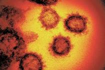 The novel coronavirus (NIAID-RML via AP)