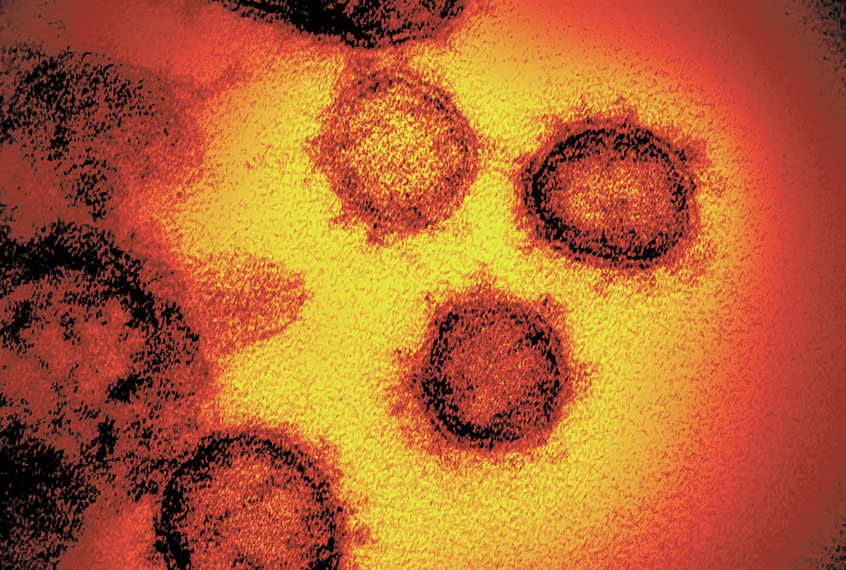 Novel coronavirus SARS-CoV-2, the virus causes COVID-19. (U.S. National Institutes of Health vi ...