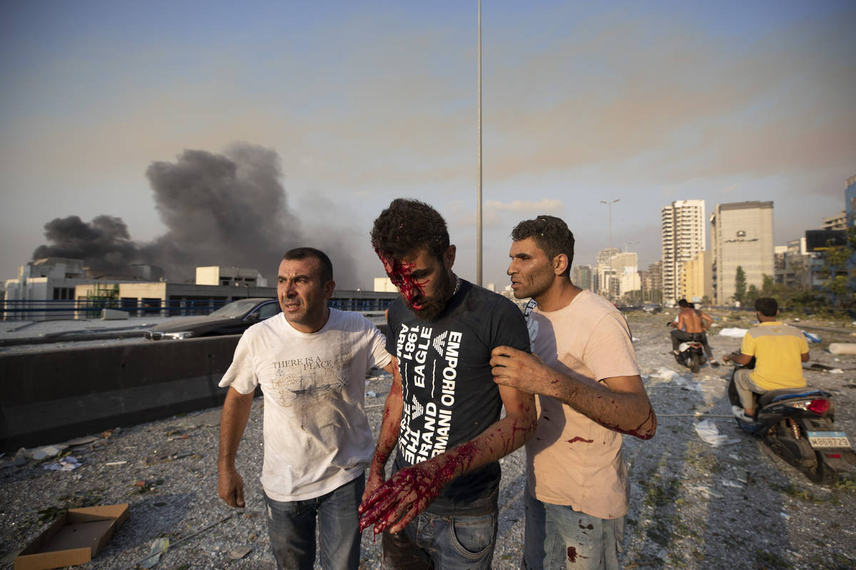 People help a man wounded in a massive explosion in Beirut, Lebanon, Tuesday, Aug. 4, 2020. Mas ...