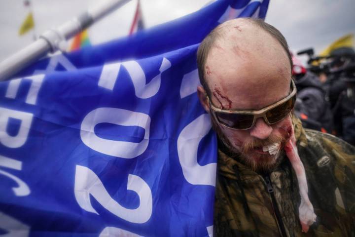 A protestor is shown injured during a confrontation with police during a rally Wednesday at the ...