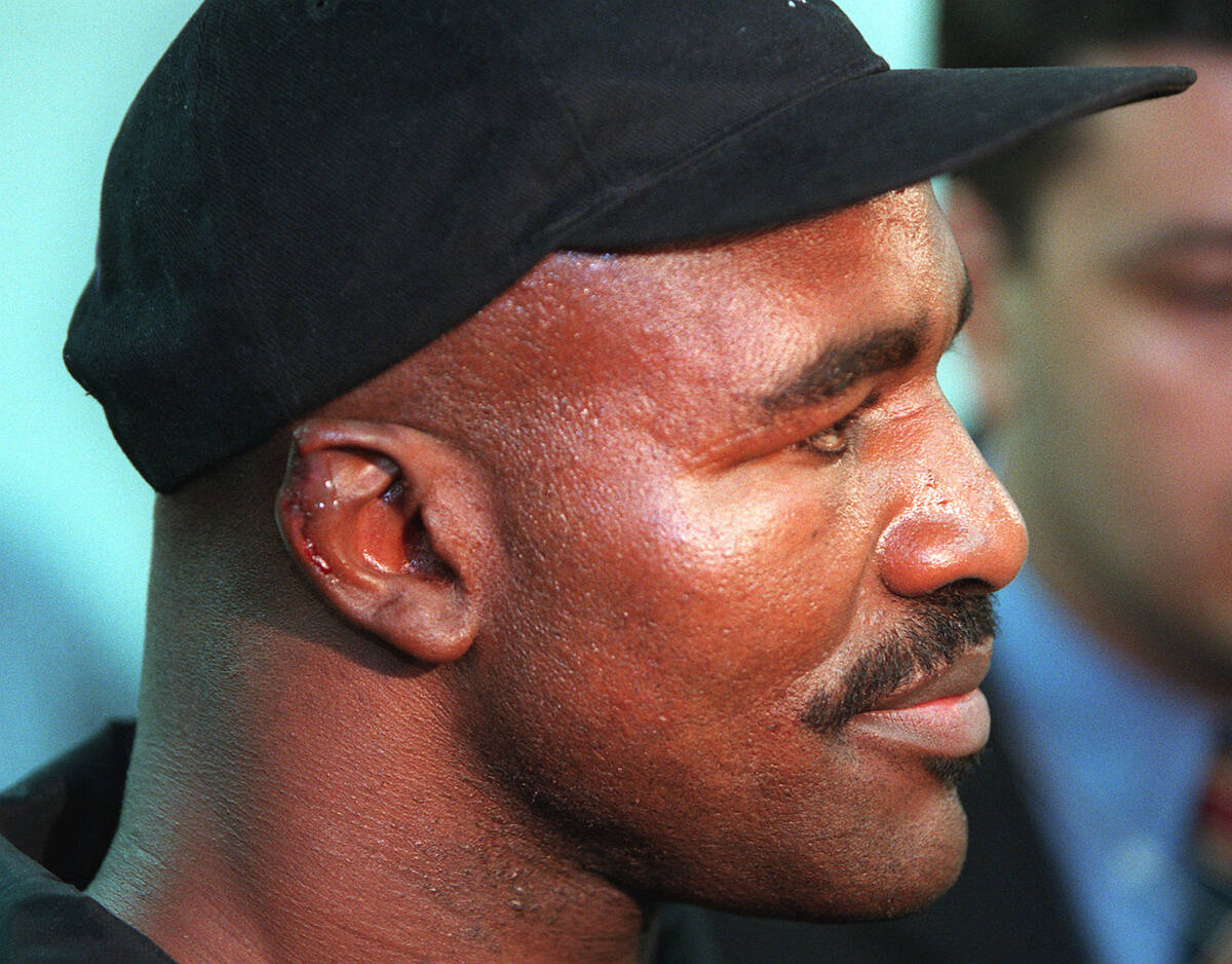Evander Holyfield's right ear, shown after medical treatment. (Review-Journal file photo)