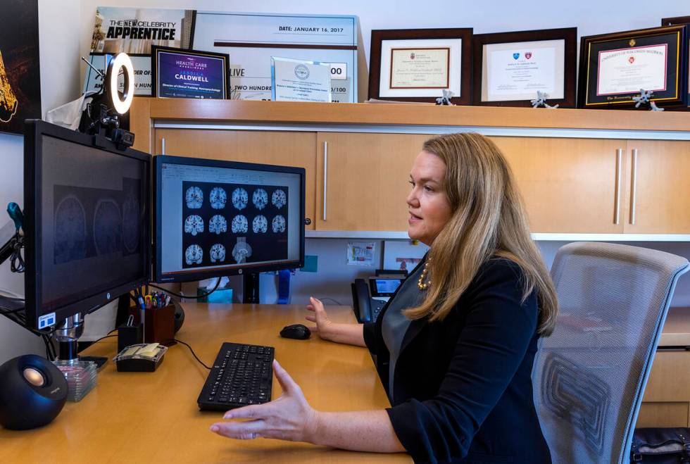 Jessica Caldwell examines brain scans at the Lou Ruvo Center for Brain Health. (L.E. Baskow/Las ...