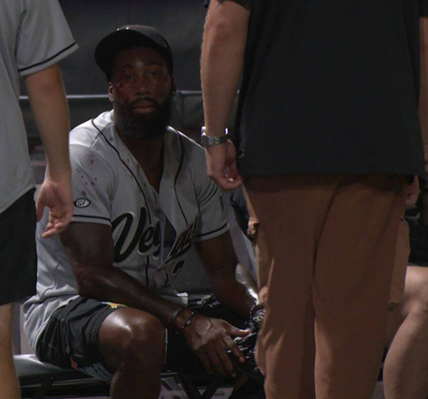 A cut can be seen above Nate Hobbs right eye after a flyball hit him in the face during the cha ...