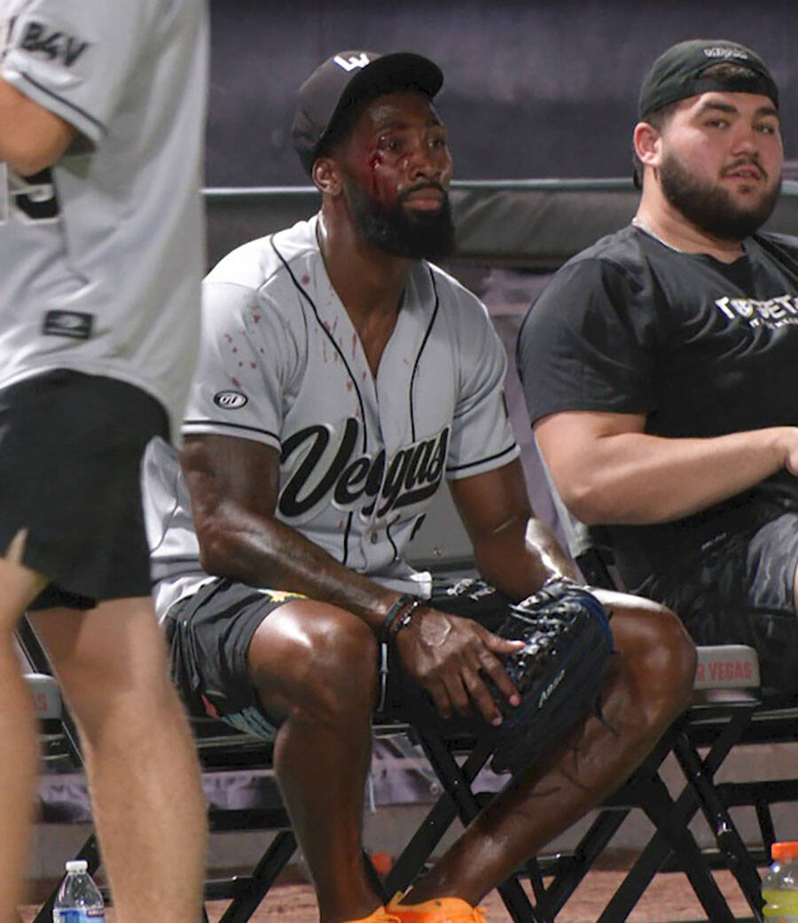 A cut can be seen above Nate Hobbs right eye after a flyball hit him in the face during the cha ...