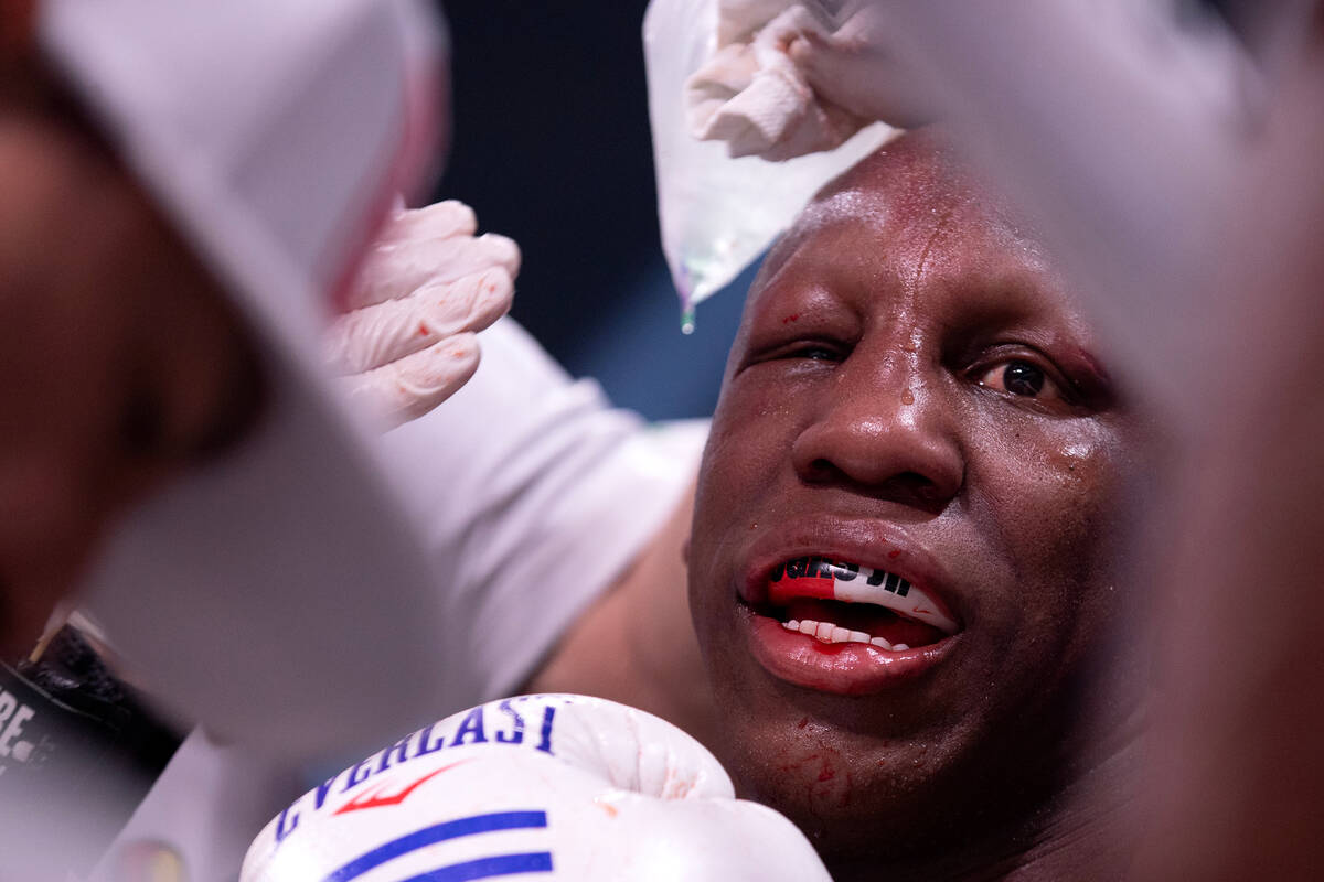 Yordenis Ugas’ face is tended to during an interim WBC welterweight title boxing bout ag ...