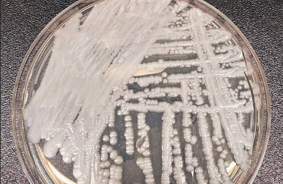 This photo shows a strain of Candida auris cultured in a petri dish at a CDC laboratory. (Shawn ...