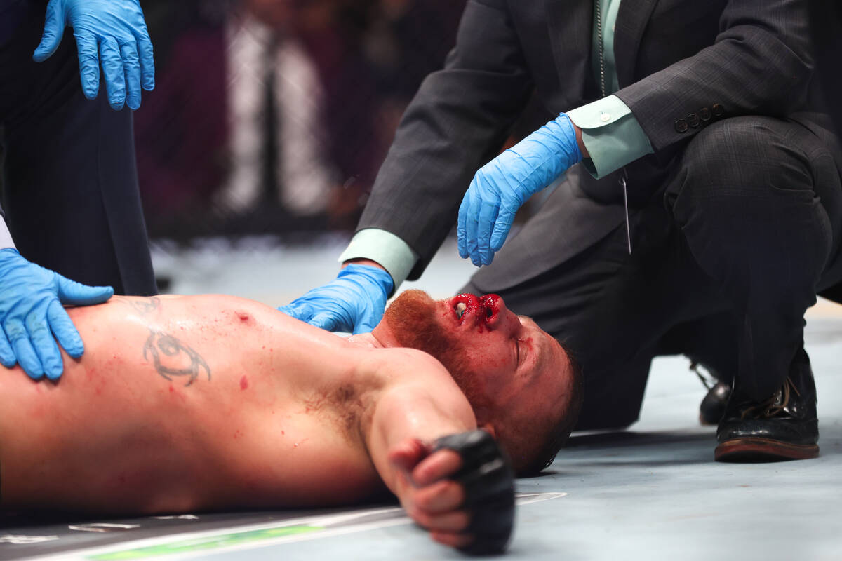 Justin Gaethje lays unconscious after Max Holloway knocked him out during a UFC 300 mixed marti ...