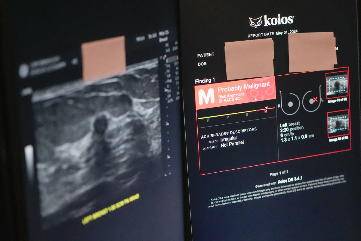 The Koios DS Smart Ultrasound software, used to get a second opinion on mammography images, is ...