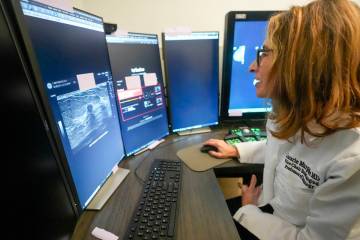 Dr. Laurie Margolies demonstrates the Koios DS Smart Ultrasound software, Wednesday, May 8, 202 ...