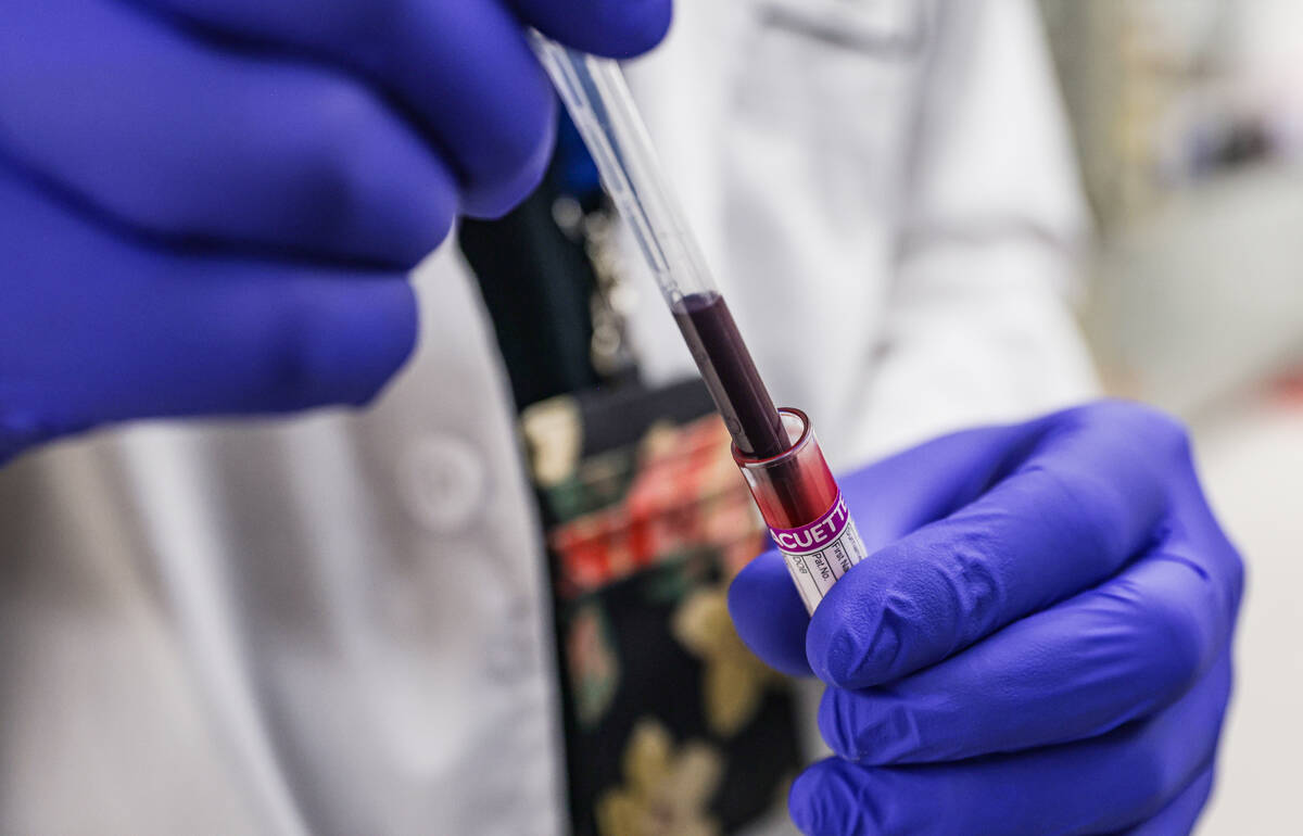 Richard Oxborough, a medical entomologist, prepares blood to feed mosquitoes in a lab at UNLV i ...