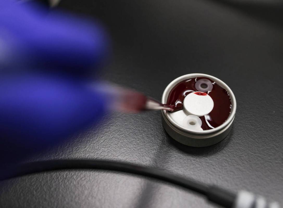 Medical entomologist Richard Oxborough prepares blood to feed mosquitoes in a lab at UNLV in La ...